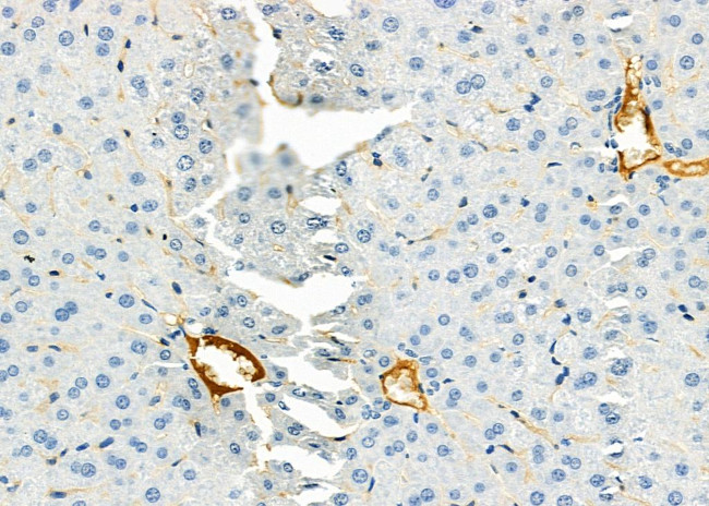 Complement Factor B Antibody in Immunohistochemistry (Paraffin) (IHC (P))