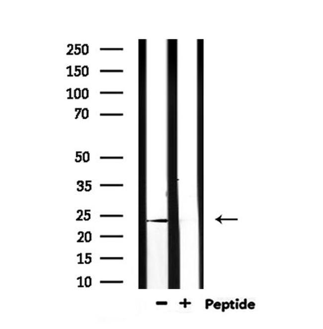 PGF Antibody in Western Blot (WB)