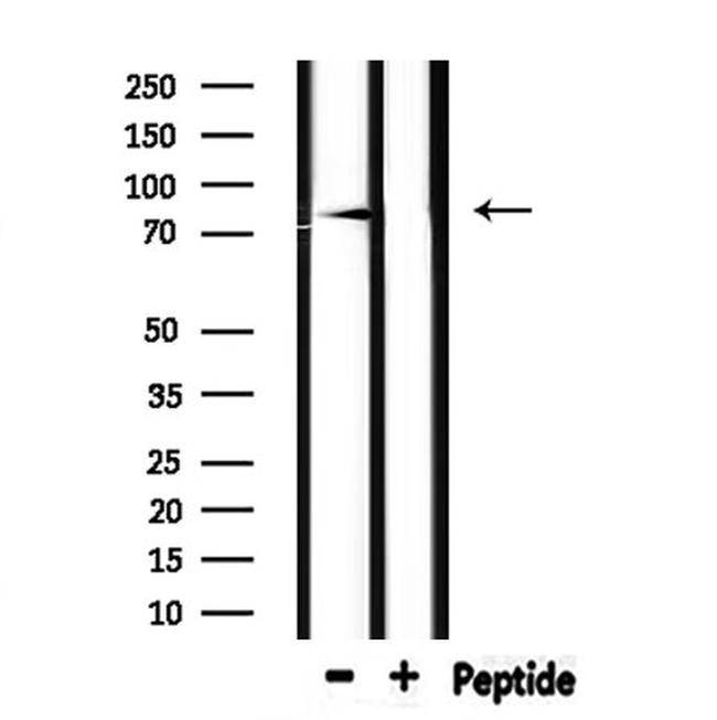 SCNN1B Antibody in Western Blot (WB)