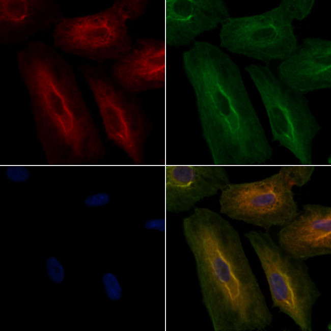 AKR1C3 Antibody in Immunocytochemistry (ICC/IF)