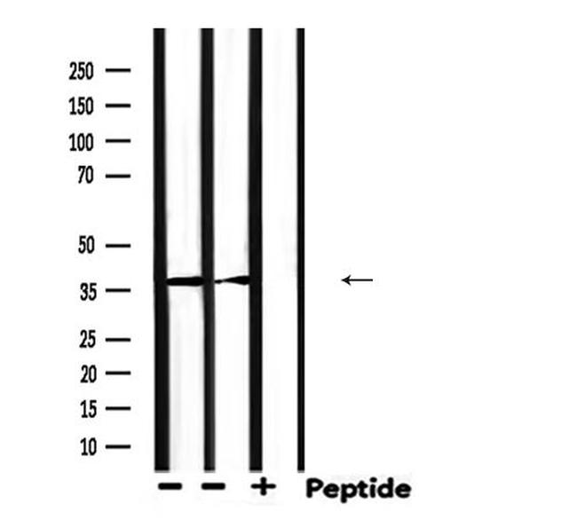 AKR1C3 Antibody in Western Blot (WB)