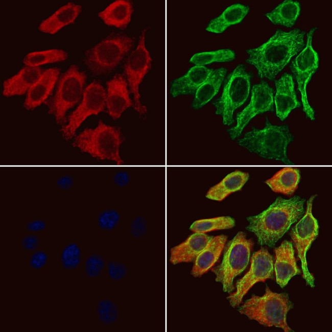 GABRA2 Antibody in Immunocytochemistry (ICC/IF)