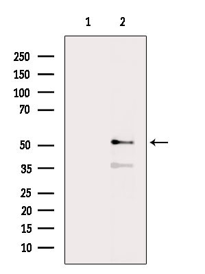 GABRA2 Antibody in Western Blot (WB)