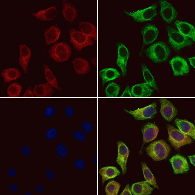 HSD3B2 Antibody in Immunocytochemistry (ICC/IF)