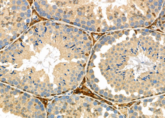 HSD3B2 Antibody in Immunohistochemistry (Paraffin) (IHC (P))