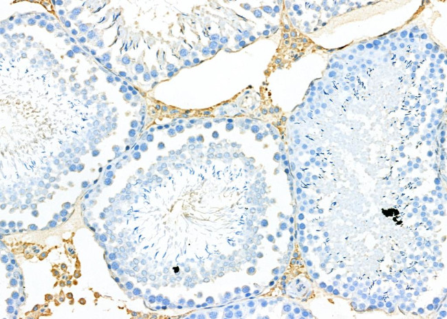 HSD3B2 Antibody in Immunohistochemistry (Paraffin) (IHC (P))