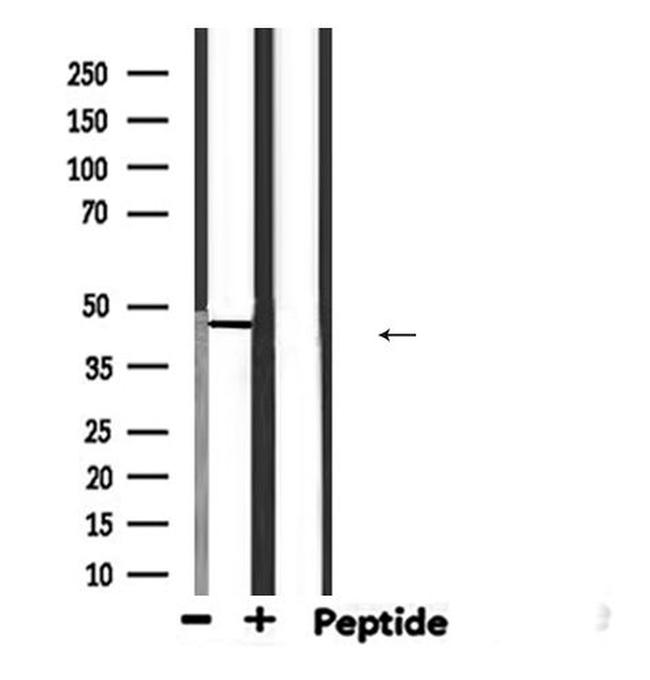 HSD3B2 Antibody in Western Blot (WB)