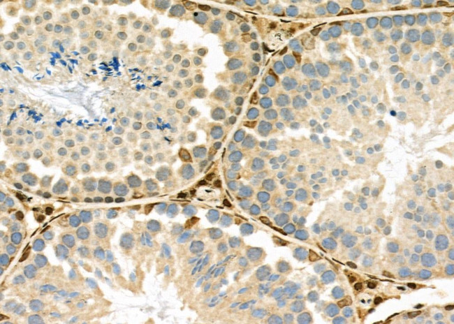 PTBP1 Antibody in Immunohistochemistry (Paraffin) (IHC (P))