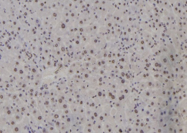 ATF3 Antibody in Immunohistochemistry (Paraffin) (IHC (P))