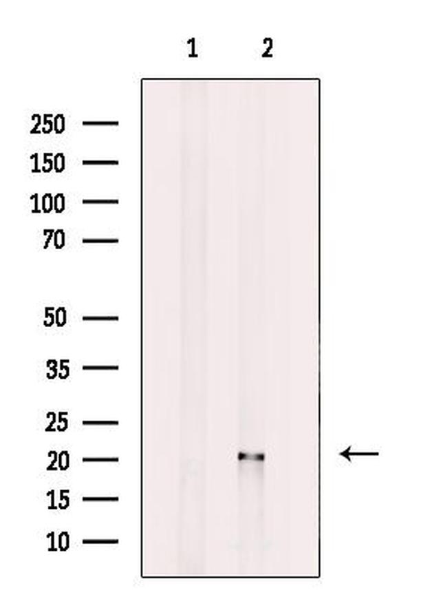 ATF3 Antibody in Western Blot (WB)