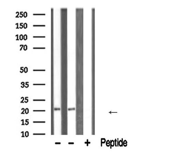 ATF3 Antibody in Western Blot (WB)