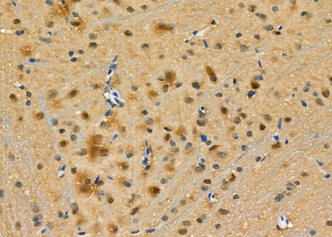 PPP2R4 Antibody in Immunohistochemistry (Paraffin) (IHC (P))