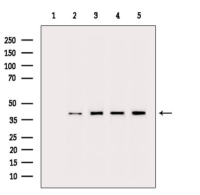 PPP2R4 Antibody in Western Blot (WB)