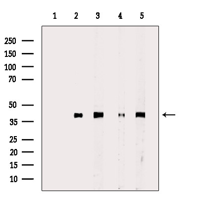 PPP2R4 Antibody in Western Blot (WB)