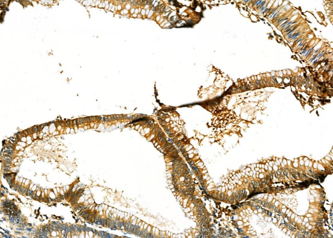 PRDX2 Antibody in Immunohistochemistry (Paraffin) (IHC (P))