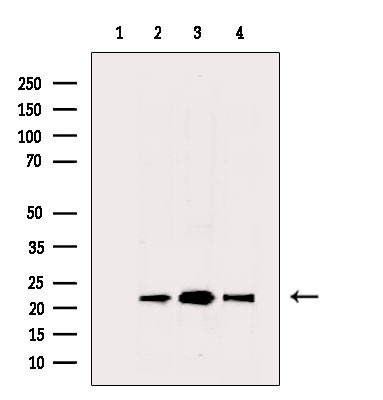 PRDX2 Antibody in Western Blot (WB)