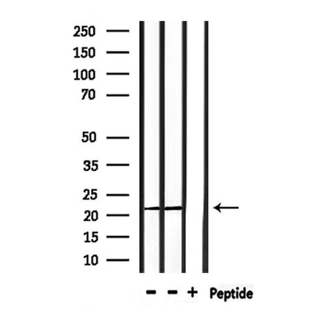 PRDX2 Antibody in Western Blot (WB)