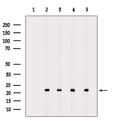 PRDX2 Antibody in Western Blot (WB)