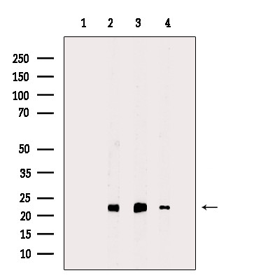 PRDX2 Antibody in Western Blot (WB)