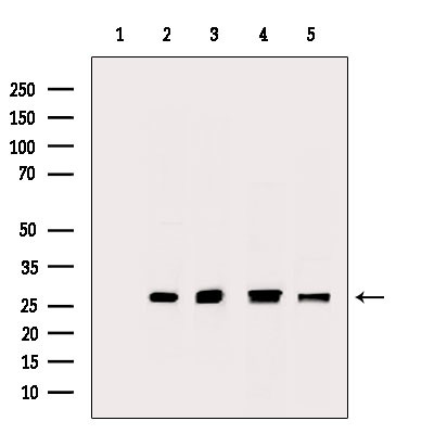 PRDX2 Antibody in Western Blot (WB)