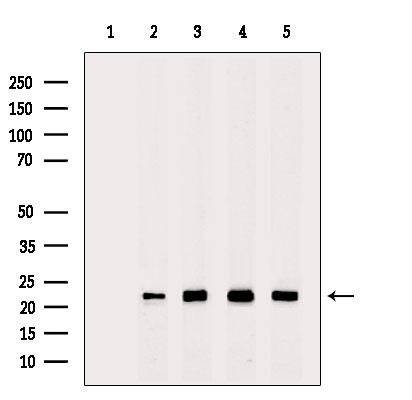 PRDX2 Antibody in Western Blot (WB)