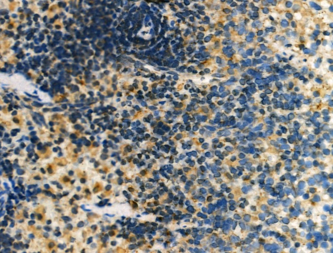 DLC1 Antibody in Immunohistochemistry (Paraffin) (IHC (P))