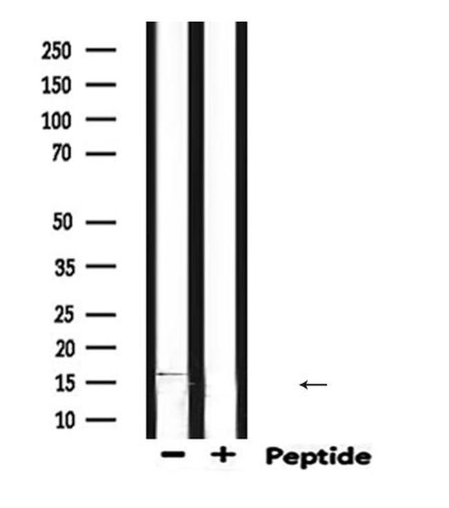 DLC1 Antibody in Western Blot (WB)