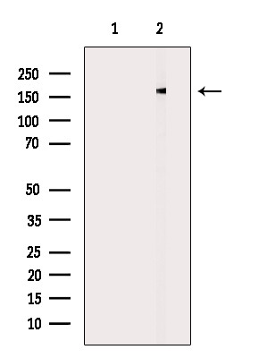 DLC1 Antibody in Western Blot (WB)