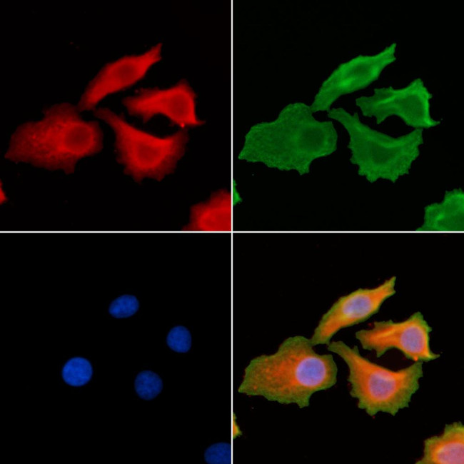 PRL3 Antibody in Immunocytochemistry (ICC/IF)