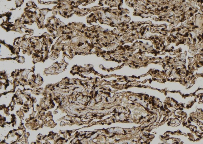 DST Antibody in Immunohistochemistry (Paraffin) (IHC (P))