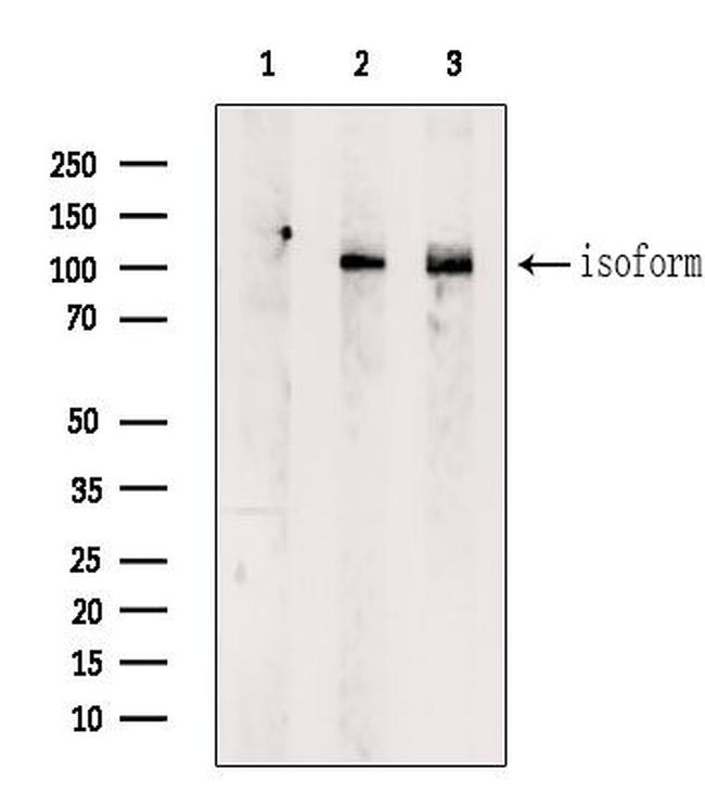 DST Antibody in Western Blot (WB)