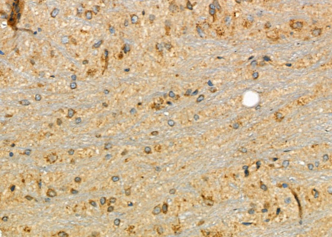 Zyxin Antibody in Immunohistochemistry (Paraffin) (IHC (P))