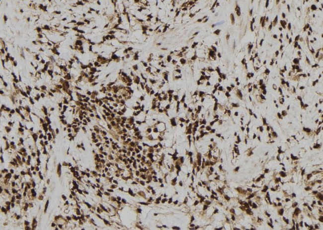 Zyxin Antibody in Immunohistochemistry (Paraffin) (IHC (P))