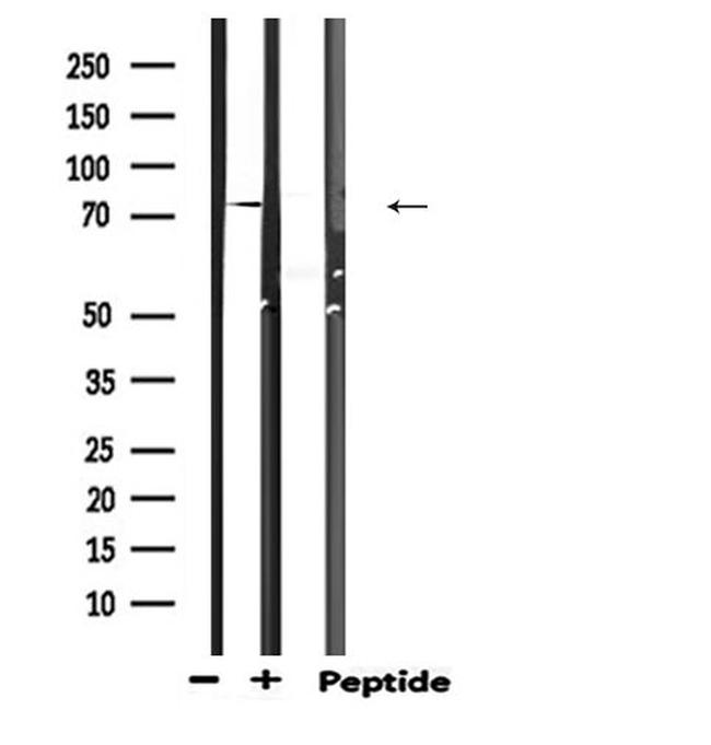 Zyxin Antibody in Western Blot (WB)