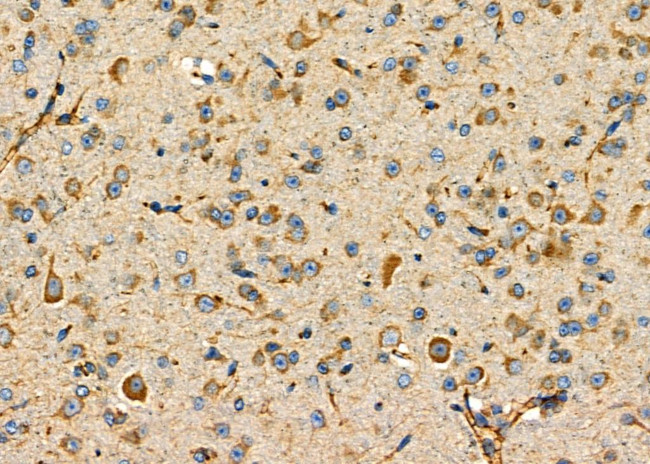 P2Y6 Antibody in Immunohistochemistry (Paraffin) (IHC (P))