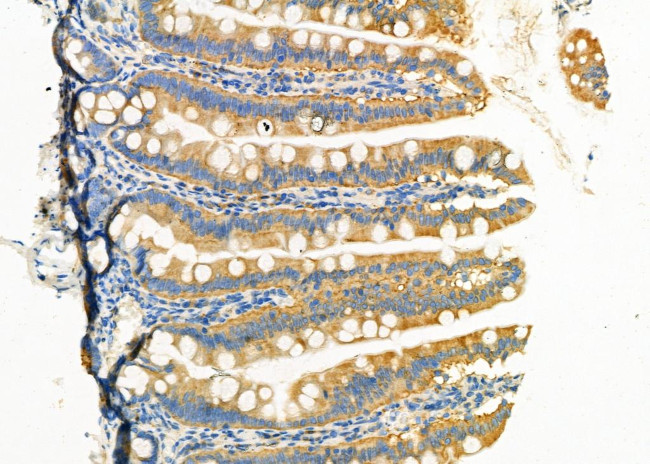 P2Y6 Antibody in Immunohistochemistry (Paraffin) (IHC (P))