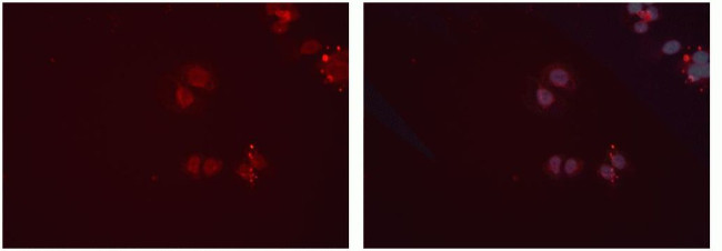 CPT2 Antibody in Immunocytochemistry (ICC/IF)