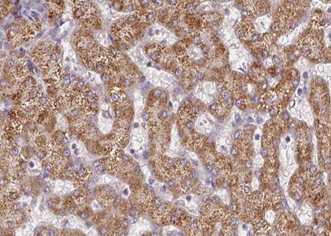 CPT2 Antibody in Immunohistochemistry (Paraffin) (IHC (P))