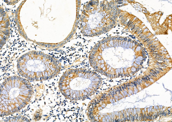 CPT2 Antibody in Immunohistochemistry (Paraffin) (IHC (P))