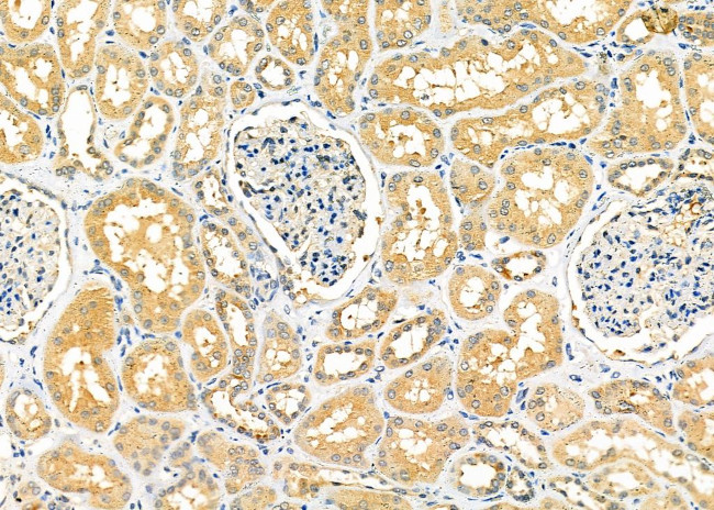 CPT2 Antibody in Immunohistochemistry (Paraffin) (IHC (P))