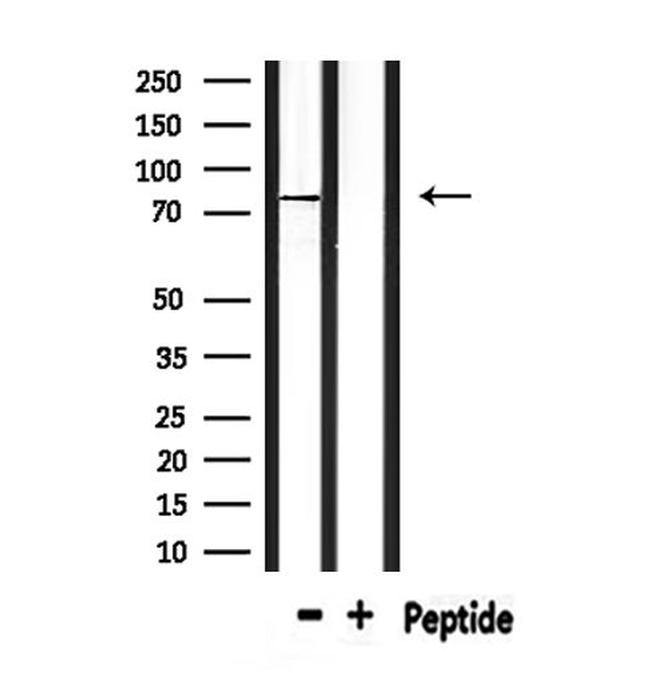 CPT2 Antibody in Western Blot (WB)