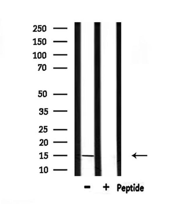 KISS1 Antibody in Western Blot (WB)