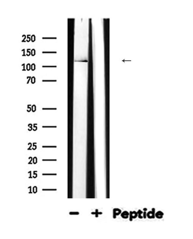 Nephrin Antibody in Western Blot (WB)