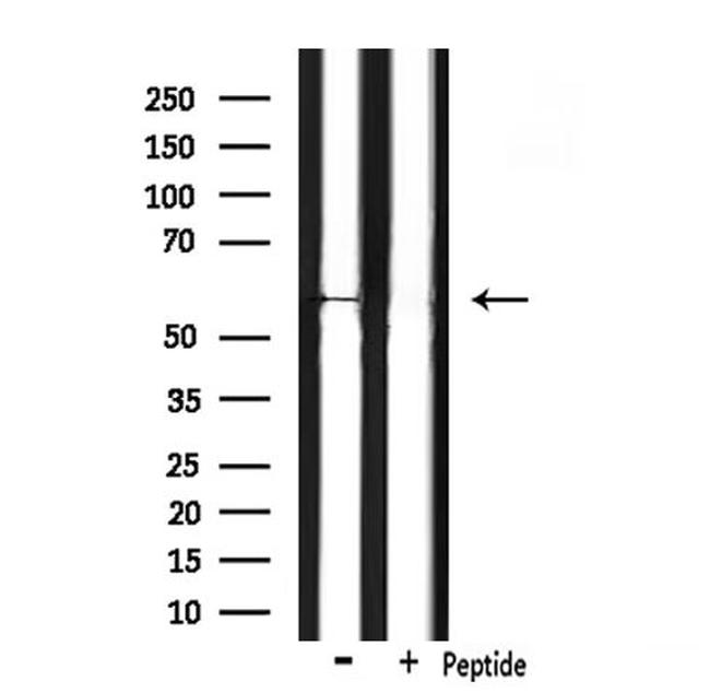 CHRM5 Antibody in Western Blot (WB)