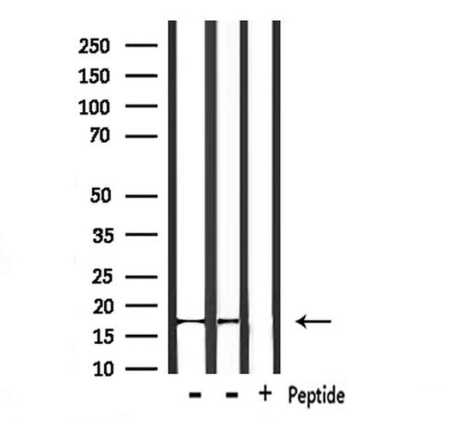 NDUFA13 Antibody in Western Blot (WB)