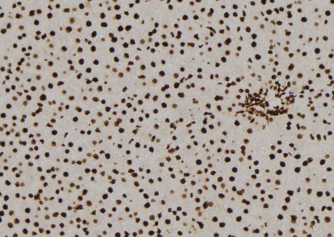 NQO2 Antibody in Immunohistochemistry (Paraffin) (IHC (P))