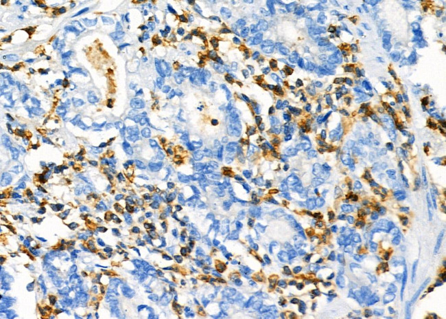 NQO2 Antibody in Immunohistochemistry (Paraffin) (IHC (P))