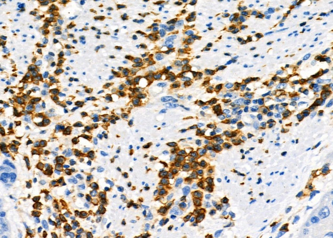 NQO2 Antibody in Immunohistochemistry (Paraffin) (IHC (P))