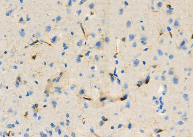 NQO2 Antibody in Immunohistochemistry (Paraffin) (IHC (P))