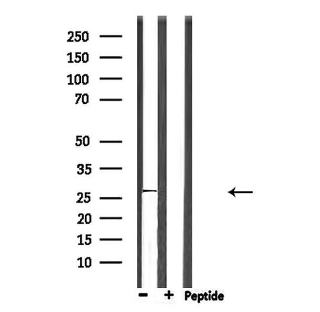 NQO2 Antibody in Western Blot (WB)